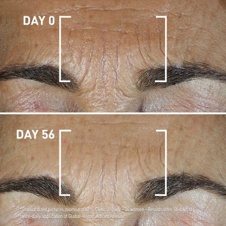 Filorga Global-Repair Advanced Intensive Elixir Youth - Image 3
